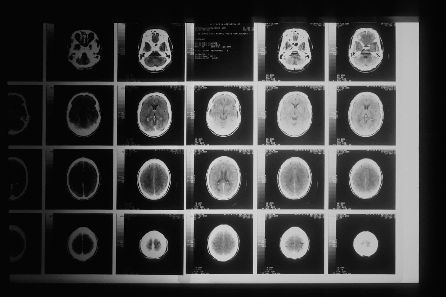 Exploring the Role of AI in Spatial Biology